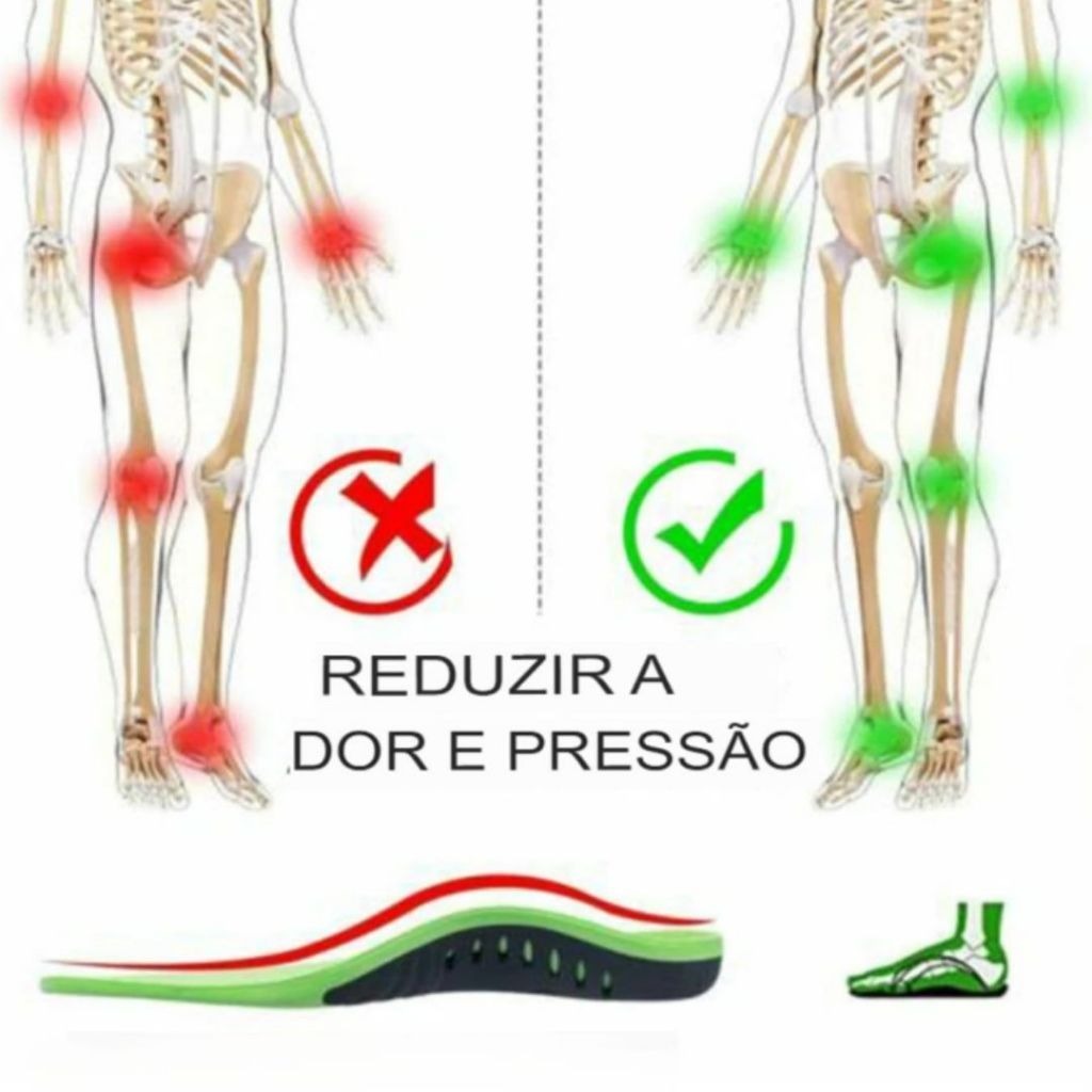 Palmilha para Fascite Plantar